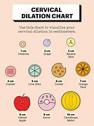 Image result for Baby Dilation Chart