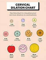 Image result for What Is a Dilation Chart