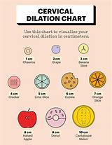Image result for Childbirth Dilation Chart