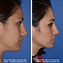 Image result for Boxy Nose Tip