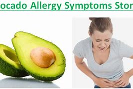 Image result for Avocado Allergy Symptoms