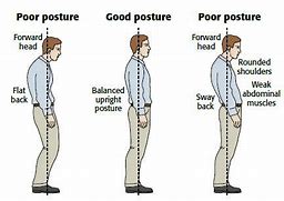 Image result for Examples of Bad Posture