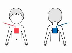 Image result for AED Pads On Chest