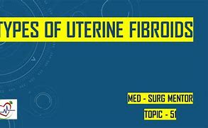 Image result for 9 Cm Uterine Fibroid
