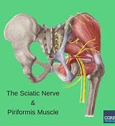 Image result for Elbow Nerve Anatomy