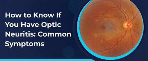 Image result for What Is a Coding Software
