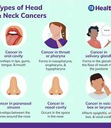 Image result for Types of Head and Neck Cancer