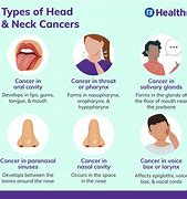 Image result for Tumor Biopsies in Head and Neck Cancer