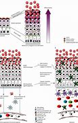 Image result for Pathogenesis of Molluscum Contagiosum