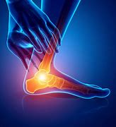 Image result for Foot Numbness and Pain