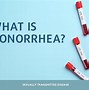 Image result for Gonorrhea Signs and Symptoms