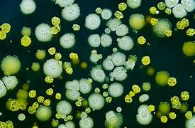 Image result for germs and bacteria pictures