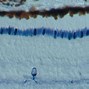 Image result for Retina Microscope