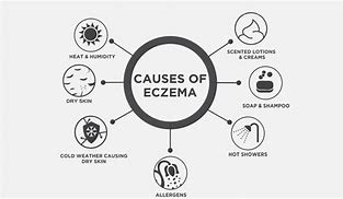 Image result for Eczema Ankle