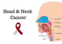 Image result for Head and Neck Cancer Face