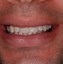 Image result for Ur 501 Jawbone