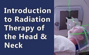 Image result for Radiation Therapy Head and Neck Cancer