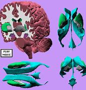 Image result for Equine Brain Anatomy