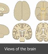 Image result for Brain 34 View