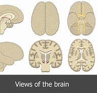 Image result for Horizontal View of Human Brain