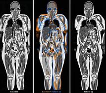 Image result for Female MRI Body Scan