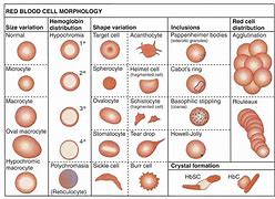 Image result for Hematology Cell Chart