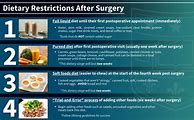 Image result for Bariatric Diet without Surgery