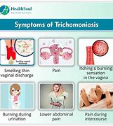 Image result for Trichomoniasis Rash