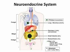 Image result for What Is Neuroendocrine