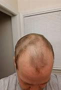 Image result for Child From Long Hair to Bald