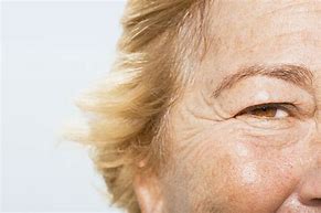 Image result for Wrinkles