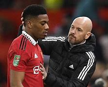 Image result for Anthony Martial Injury