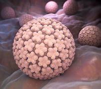 Image result for Male Genital Warts