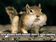 Image result for Wisdom Tooth MEME Funny