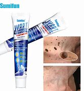 Image result for Wart and Skin Tag Removal Cream