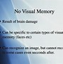 Image result for Eidetic Memory