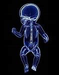 Image result for Baby Skeleton Clip Art