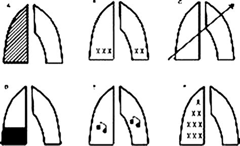 Image result for Pattern Classification Using Perceptron