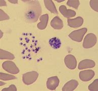 Image result for Blood Parasites