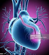 Image result for After Heart Bypass Surgery