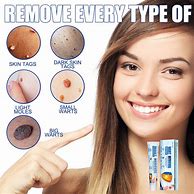 Image result for Wart and Skin Tag Removal Cream