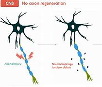 Image result for Neuron Damage