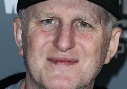 Image result for Michael Rapaport Cold Sore