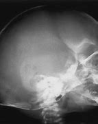 Image result for Human Infant Skull