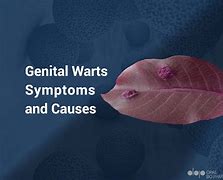 Image result for Mild Male Genital Warts