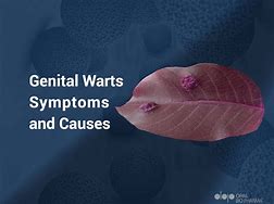 Image result for Warts On Genital Area