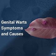 Image result for Genital Warts Symptoms