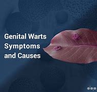 Image result for Female Genital Warts