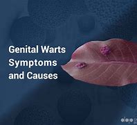 Image result for Effects of Genital Warts