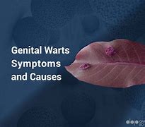 Image result for Genital Warts Dermnet